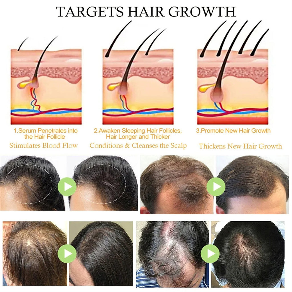Natural Hair Growth Oil, Organic Veganic Natural Hair Growth Oil,Pure Natural Hair Density Essential Oil, Plant Extract Hair Growth Oil for Dry Damaged Hair and Growth (3Pcs)