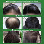 Raw Batana Oil for Hair Growth 100% Natural Raw and Pure Unrefined Batana Oil Dr. Sebi Organic Hair Oil,Prevent Hair Loss,Restores Damaged Hair and Scalp,Moisturize Scalp 4.05 OZ