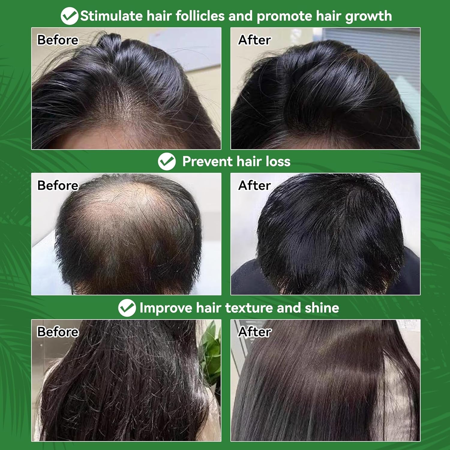 Raw Batana Oil for Hair Growth 100% Natural Raw and Pure Unrefined Batana Oil Dr. Sebi Organic Hair Oil,Prevent Hair Loss,Restores Damaged Hair and Scalp,Moisturize Scalp 4.05 OZ
