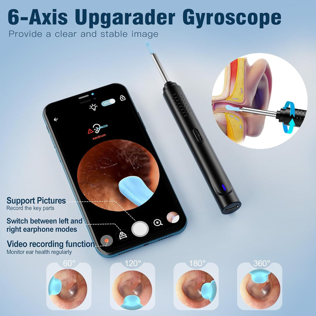Ear Wax Removal, Ear Cleaner with Camera with 1296P, Earwax Removal Kit with 9 Ear Pickand 8 Traditional Tools, Built-In Wifi Lp67 Waterproof, Ear Cleaning Kit Foriphone,Ipad,Android (Black)