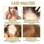 Natural Hair Growth Oil, Organic Veganic Natural Hair Growth Oil,Pure Natural Hair Density Essential Oil, Plant Extract Hair Growth Oil for Dry Damaged Hair and Growth (3Pcs)